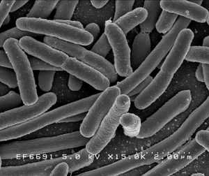 e coli bacteria